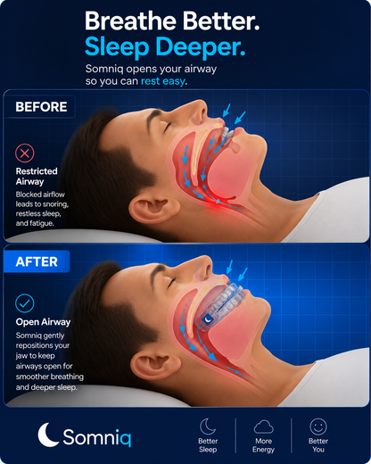 THE COMFORTABLE, NON-TOXIC ANTI-SNORE DEVICE